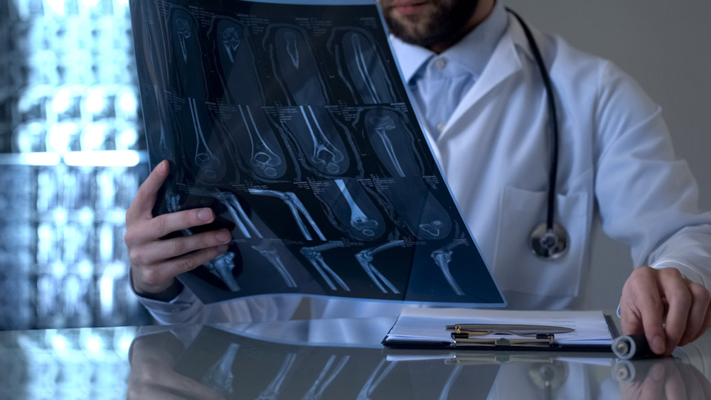 En läkare kollar på röntgenplåtar